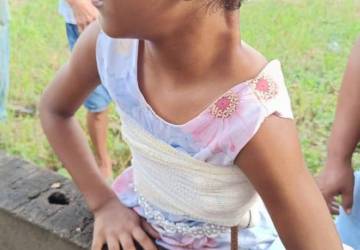 Menina de 8 anos sobrevive a grave acidente em Novo Progresso e passa por cirurgia de emergência em Itaituba