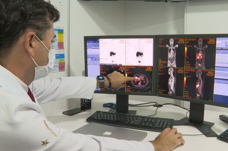 Câncer de próstata tem novo tratamento com radioterapia reduzida