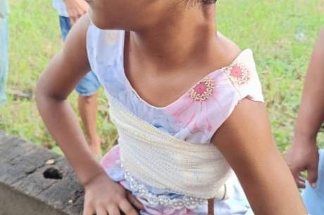 Menina de 8 anos sobrevive a grave acidente em Novo Progresso e passa por cirurgia de emergência em Itaituba