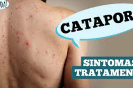 Dr. Ajuda: qual a relação da catapora com o herpes Zoster?